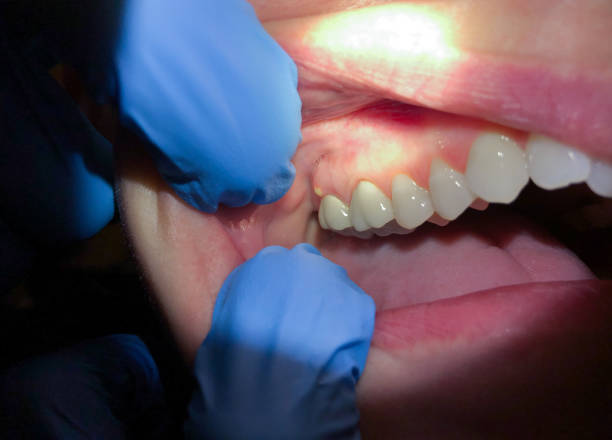 Best Emergency Broken Tooth Repair in Leonardo, NJ
